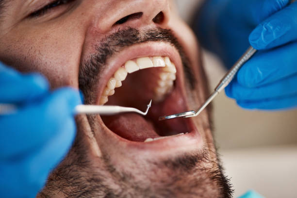 Best Root Canal Treatment  in Salem, IN